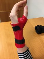 Hand Therapy